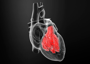 Heart enlargement (cardiomegaly)